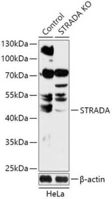 Knockout Validated: LYK5 Antibody - Azide and BSA Free [NBP3-03612]