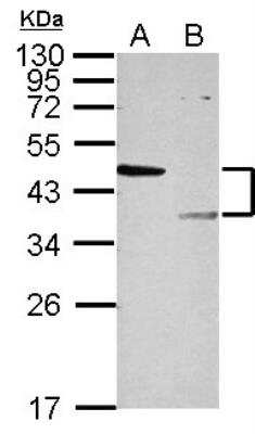 Western Blot: LYK5 Antibody [NBP2-17187]