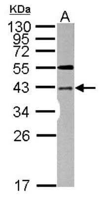 Western Blot: LYK5 Antibody [NBP2-17187]