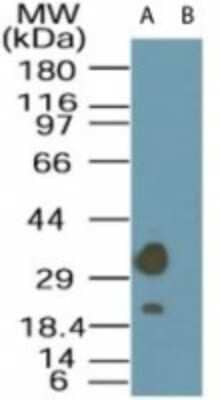 Western Blot: LYK5 Antibody [NBP2-24700]