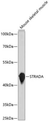 Western Blot: LYK5 AntibodyBSA Free [NBP3-03613]