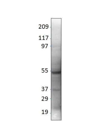 Western Blot: LYK5 Antibody [NBP3-12322]