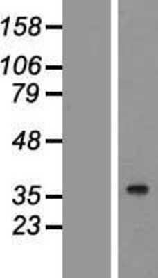 Western Blot: LYK5 Overexpression Lysate [NBP2-05254]