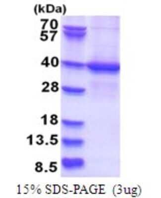 SDS-PAGE: Recombinant Human LYK5 His Protein [NBP2-51734]