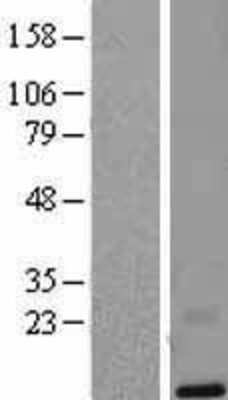 Western Blot: SLURP2 Overexpression Lysate [NBL1-12754]
