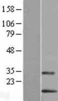 Western Blot: LYNX1 Overexpression Lysate [NBL1-12755]