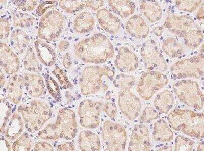 Immunohistochemistry-Paraffin: LYPD2 Antibody [NBP3-06039]