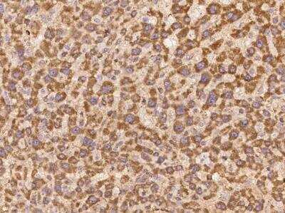 Immunohistochemistry-Paraffin: LYPD2 Antibody [NBP3-06039]