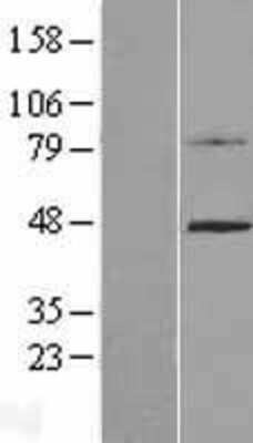 Western Blot: C4.4A/LYPD3 Overexpression Lysate [NBP2-07341]