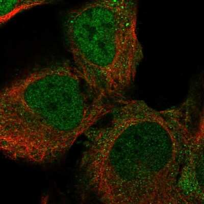 Immunocytochemistry/ Immunofluorescence: LYPD5 Antibody [NBP1-83549]