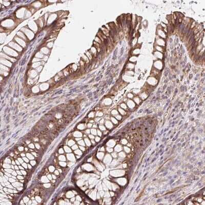 Immunohistochemistry-Paraffin: LYPD5 Antibody [NBP2-49144]