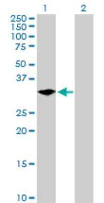 Western Blot: LYPD5 Antibody [H00284348-B01P]