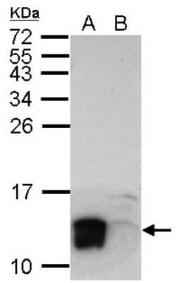 Western Blot: LYPD6 Antibody [NBP2-17190]