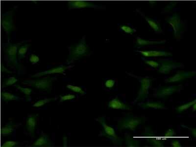 Immunocytochemistry/ Immunofluorescence: LYPLA1 Antibody (3D5) [H00010434-M05]