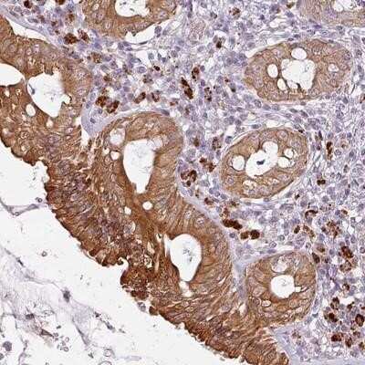 Immunohistochemistry-Paraffin: LYPLA1 Antibody [NBP2-14209]