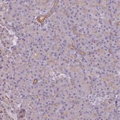 Immunohistochemistry-Paraffin: LYPLA1 Antibody [NBP2-14209]