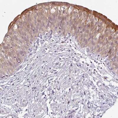 Immunohistochemistry-Paraffin: LYPLA1 Antibody [NBP2-14209]