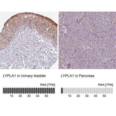 Immunohistochemistry-Paraffin: LYPLA1 Antibody [NBP2-14209]
