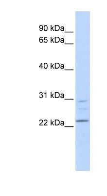 Western Blot: LYPLA1 Antibody [NBP1-54612]