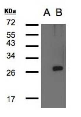 Western Blot: LYPLA1 Antibody [NBP2-17191]