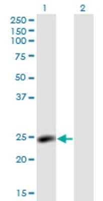 Western Blot: LYPLA2 Antibody (3H5) [H00011313-M01]