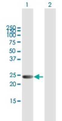 Western Blot: LYPLA2 Antibody [H00011313-B01P]