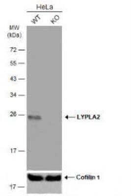 Western Blot: LYPLA2 Antibody [NBP1-31538]