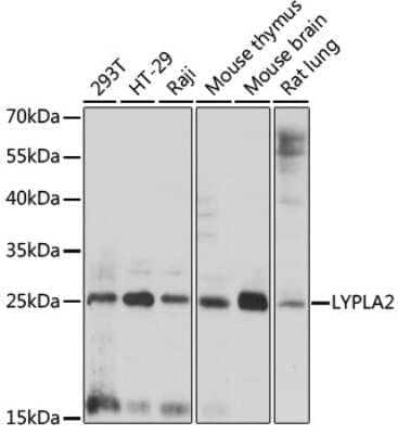 Western Blot: LYPLA2 AntibodyAzide and BSA Free [NBP3-04729]