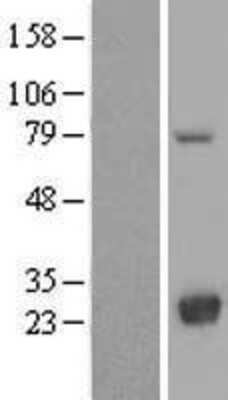 Western Blot: LYPLA2 Overexpression Lysate [NBL1-12761]