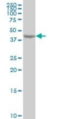 Western Blot: LYPLA3 Antibody (3B11) [H00023659-M01]