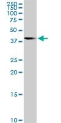 Western Blot: LYPLA3 Antibody (3B11) [H00023659-M01]