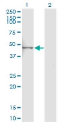 Western Blot: LYPLA3 Antibody (3B11) [H00023659-M01]