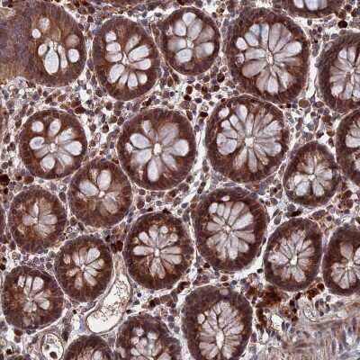 Immunohistochemistry-Paraffin: LYPLA3 Antibody [NBP1-92088]