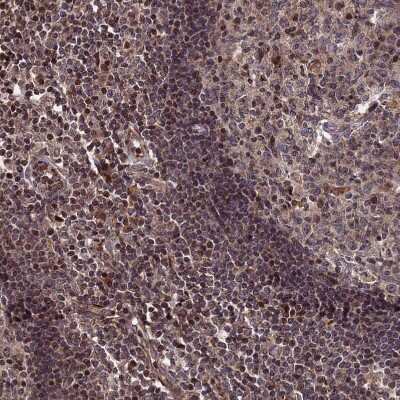 Immunohistochemistry-Paraffin: LYPLA3 Antibody [NBP1-92088]