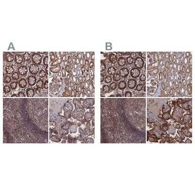 Immunohistochemistry-Paraffin: LYPLA3 Antibody [NBP1-92088]