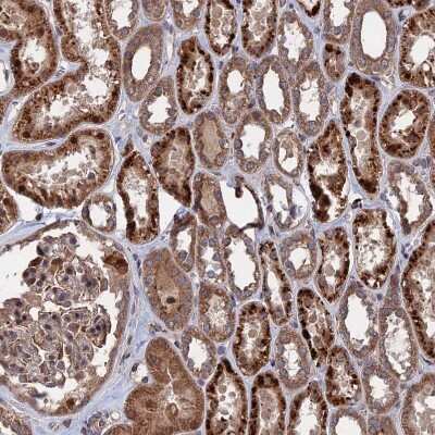Immunohistochemistry-Paraffin: LYPLA3 Antibody [NBP1-92088]