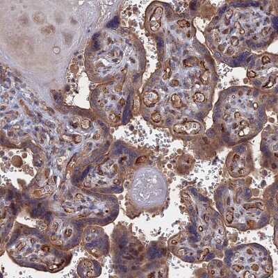 Immunohistochemistry-Paraffin: LYPLA3 Antibody [NBP1-92088]
