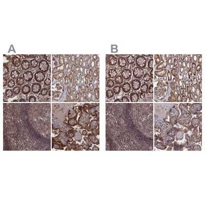 Immunohistochemistry-Paraffin: LYPLA3 Antibody [NBP1-92089]