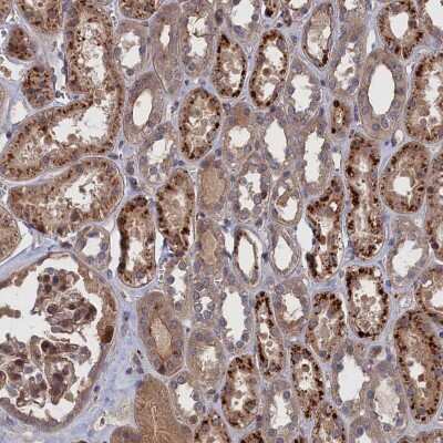 Immunohistochemistry-Paraffin: LYPLA3 Antibody [NBP1-92089]