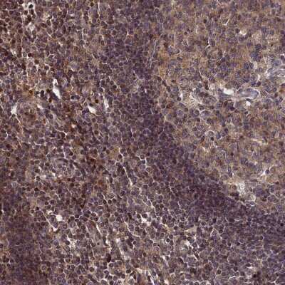 Immunohistochemistry-Paraffin: LYPLA3 Antibody [NBP1-92089]