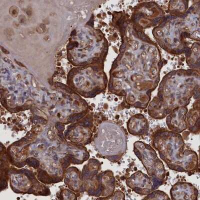 Immunohistochemistry-Paraffin: LYPLA3 Antibody [NBP1-92089]