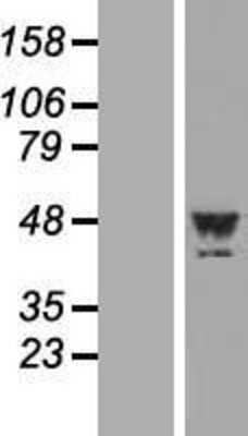 Western Blot: LYPLA3 Overexpression Lysate [NBL1-12762]