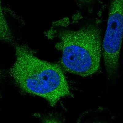 Immunocytochemistry/ Immunofluorescence: LYPLAL1 Antibody [NBP1-92090]