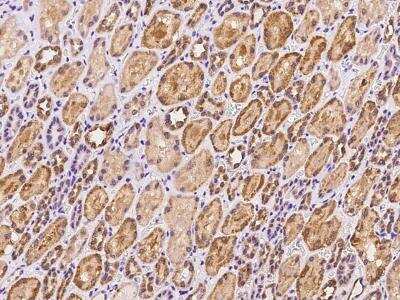 Immunohistochemistry-Paraffin: LYPLAL1 Antibody [NBP3-06252]
