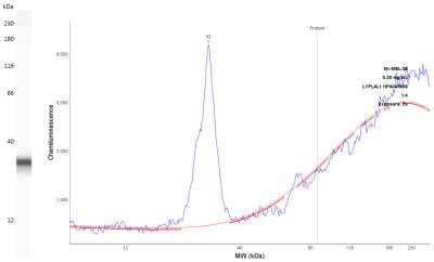 Simple Western: LYPLAL1 Antibody [NBP1-92090]
