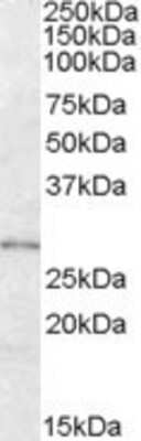 Western Blot: LYPLAL1 Antibody [NBP1-00210]