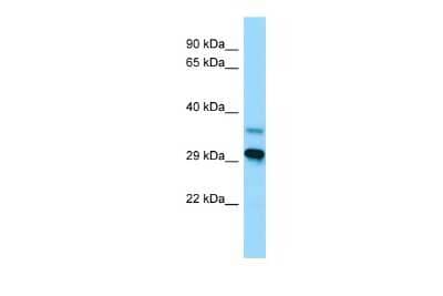 Western Blot: LYPLAL1 Antibody [NBP2-85245]