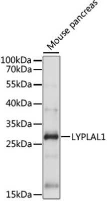 Western Blot: LYPLAL1 AntibodyAzide and BSA Free [NBP3-03916]