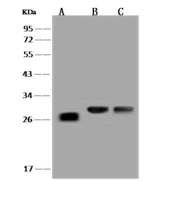 Western Blot: LYPLAL1 Antibody [NBP3-06252]