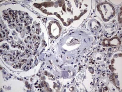 Immunohistochemistry: Metadherin Antibody (OTI1B6) [NBP2-46026]